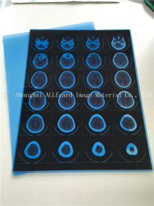 Medical X-ray Blue Film, Printing Film for Dicom Images Output